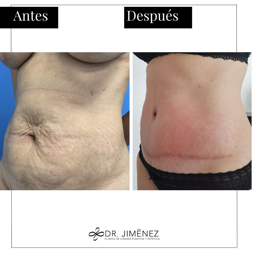 Clinic Results Gallery